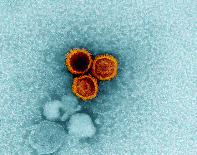 Skok v boji s rakovinou i roztroušenou sklerózou. Vakcína na smrtící virus je blíž